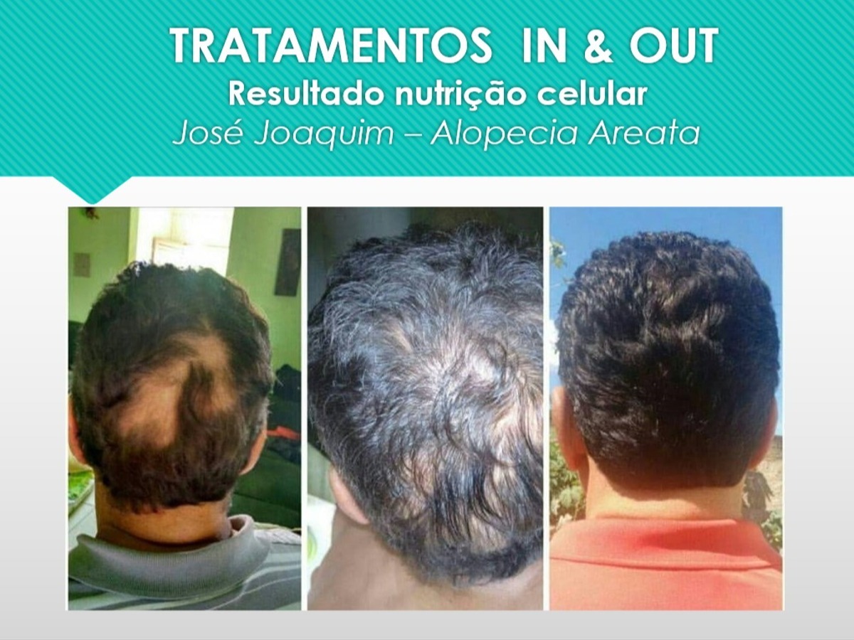 Suelii Nogueira  Estética IN - OUT